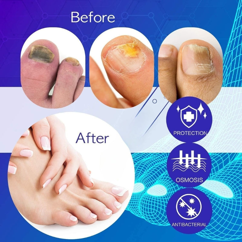 FungalAid™ – Anti-Fungal & Anti-Odor Spray | Prevents Nail & Foot Infections