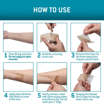 DermaEase™ | Silicone Scar Gel Sheet