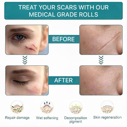 DermaEase™ | Silicone Scar Gel Sheet